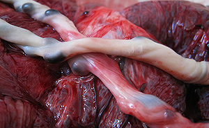 the umbilical cord lies looped over the placenta