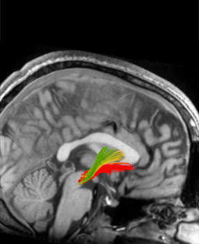 Neuroscience of need - Understanding the addicted mind
