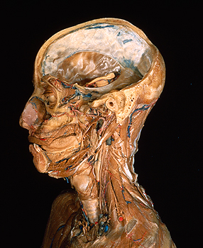 dissected head