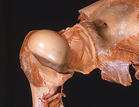 The shoulder joint, opened from behind