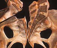the pelvic bones