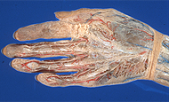 The right hand, revealing tendons, blood vessels and nerves